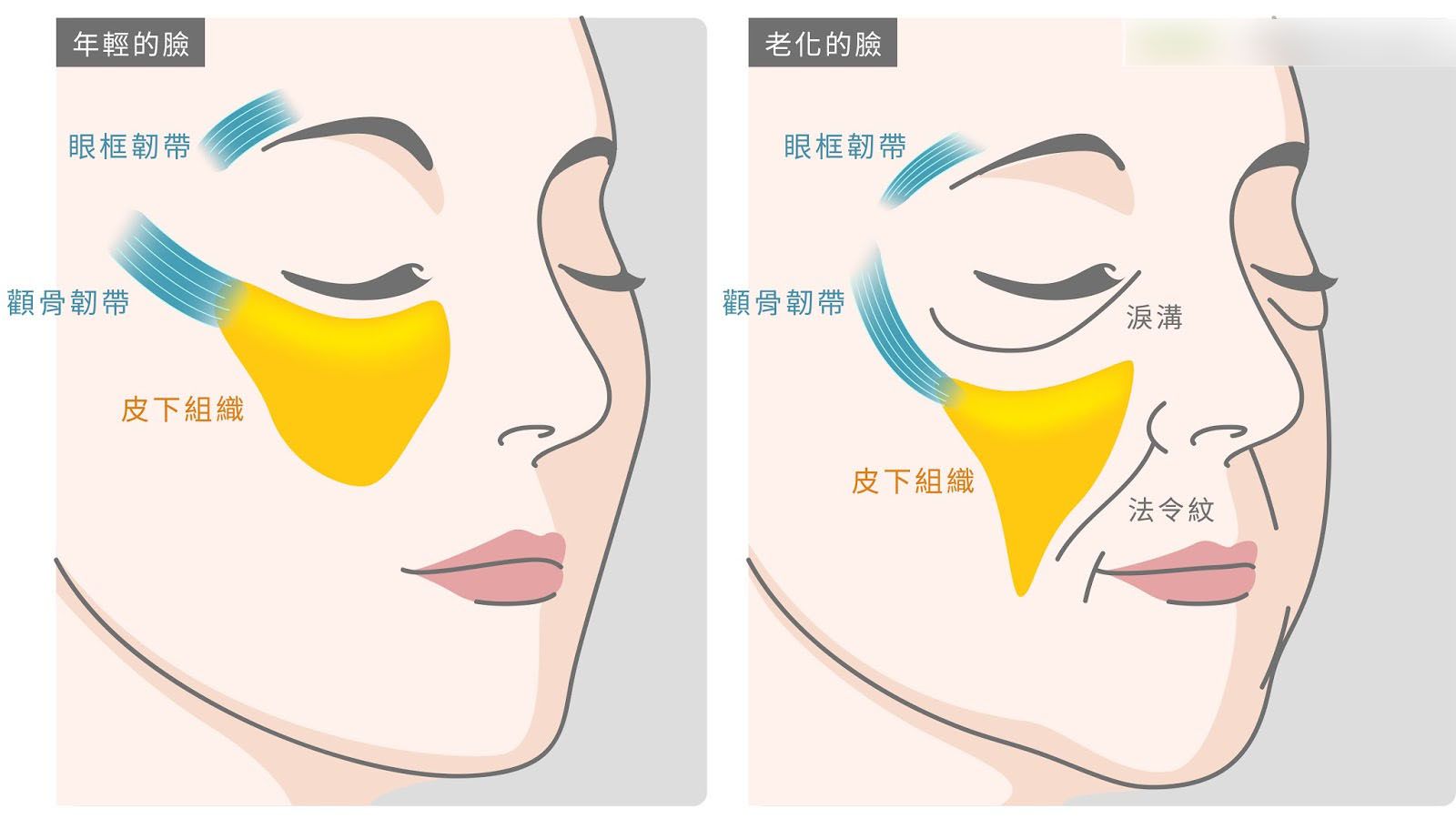 法令紋與蘋果肌