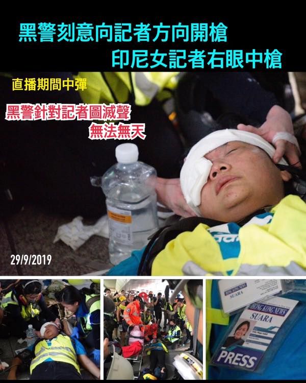 香港黑警射爆女記者眼