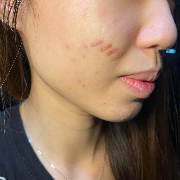 einxel plus好唔好