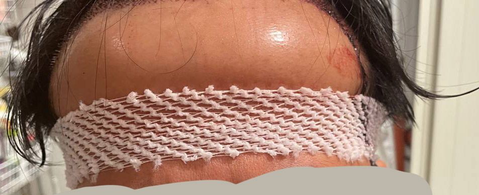 深圳植髮邊間好